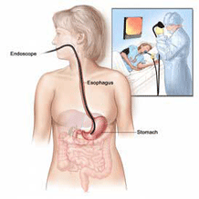 endoscopy