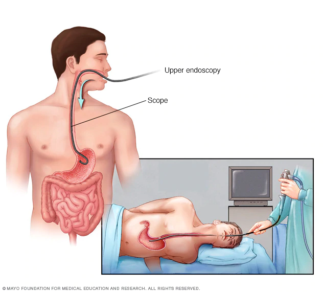 mcdc7_endoscopy-8col